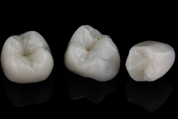 Are Dental Crowns Considered Cosmetic Dentistry?